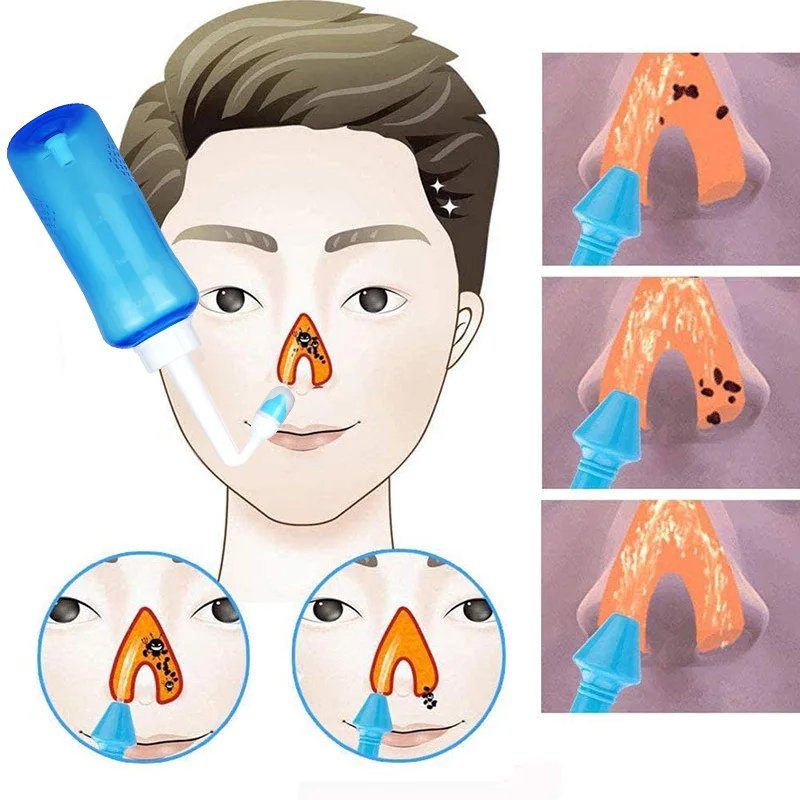 Nosies Irrigator Nosį Plauti Švaresnis Butelis Neti Puodą Išvengti Alerginio Rinito Sinusinio Skalavimo Sveikatos Priežiūros Bionase Prietaiso Skrepliai Vaikas